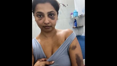 Who is Anicka Vikhraman, know the Malayalam actress' tragic story, when she was tortured by her ex-boyfriend