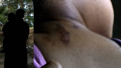 രണ്ടേകാൽ വയസ്സുകാരനെ അച്ഛൻ ചൂടുവെള്ളം ഒഴിച്ചു പൊള്ളിച്ചു, പരാതിയുമായി അമ്മ