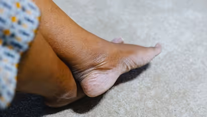 Skincare tips: 6 ways to keep your heels crack-free and healthy this summer