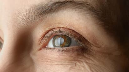 പുകവലി തിമിരത്തിലേക്ക് നയിക്കുമോ? അറിയേണ്ട കാര്യങ്ങള്...