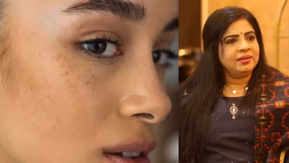 മുഖത്തെ കറുത്ത പാടുകള് മാറ്റാം ഈസിയായി; ടിപ്സ് പങ്കുവച്ച് അനില ജോസഫ്...