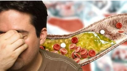 కొలెస్ట్రాల్ ను తగ్గించే ఎఫెక్టీవ్ చిట్కాలివి..