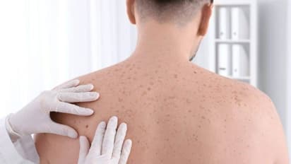 ചര്‍മ്മത്തില്‍ കാണുന്ന ഈ സൂചനകളെ നിസാരമായി കാണരുത്...