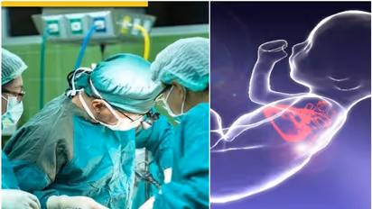 മെഡിക്കൽ മിറാക്കിൾ!, ​ഗർഭസ്ഥ ശിശുവിന് ഹൃദയശസ്ത്രക്രിയ നടത്തി ദില്ലി എയിംസ്, പൂർത്തിയാക്കിയത് 90 സെക്കൻഡിൽ