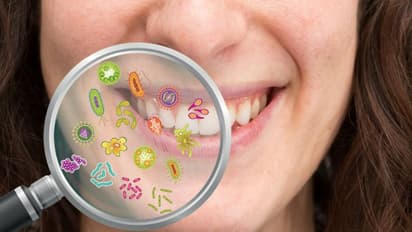 പല്ലുകളുടെ ആരോഗ്യം സംരക്ഷിക്കാന്‍ ശ്രദ്ധിക്കേണ്ട ചില കാര്യങ്ങള്‍...