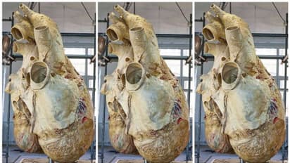 ಅಬ್ಬಬ್ಬಾ..ತಿಮಿಂಗಿಲದ ಹೃದಯ ಇಷ್ಟೊಂದು ದೊಡ್ಡದಾ  ಎಷ್ಟು ಕೆಜಿಯಿದೆ ಗೊತ್ತಾ?