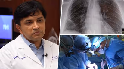 Miracle! How 'Bharat' helped woman become 2nd person to be CURED of terminal stage 4 lung cancer