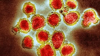 കാസർകോട് അഞ്ച് വിദ്യാർത്ഥികൾക്ക് എച്ച്3എൻ2, എച്ച്1എൻ1 രോഗബാധ സ്ഥിരീകരിച്ചു; ആശുപത്രിയിൽ പ്രവേശിപ്പിച്ചു