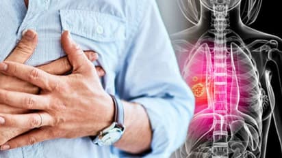 Unveiling hidden dangers - 8 surprising risk factors for Lung Cancer you should be aware of