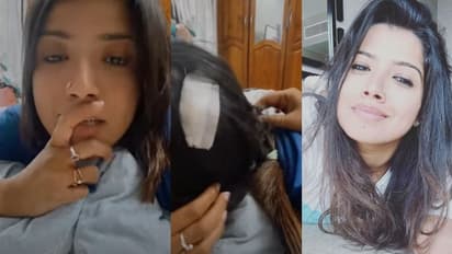 'രണ്ട് സ്റ്റിച്ചുണ്ട്, നല്ല വേദനയാണ്'; അമൃത സുരേഷിന്റെ തലയ്ക്ക് പരിക്ക്