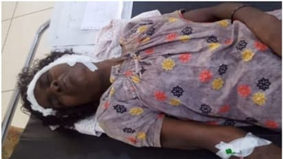 പശുവിന് വെള്ളം കൊടുക്കാൻ പോയപ്പോള് അപ്രതീക്ഷിത വരവ്; കാട്ടാന ആക്രമണത്തില് വയോധികയ്ക്ക് പരിക്ക്