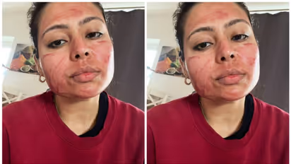 ചര്‍മ്മ സംരക്ഷണത്തിന് രക്തം; ട്വിറ്ററില്‍ വൈറലായി ഒരു തമാശ കുറിപ്പ് 