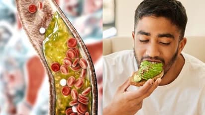 ചീത്ത കൊളസ്ട്രോള് കുറയ്ക്കാന് ഒഴിവാക്കേണ്ടതും കഴിക്കേണ്ടതുമായ ഭക്ഷണങ്ങള്...