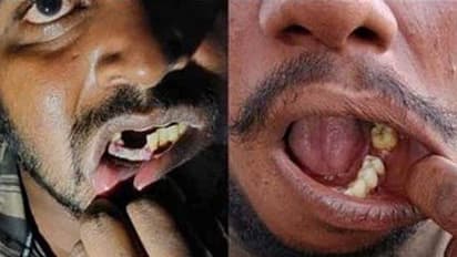 కటింగ్ ప్లేయర్ తో పళ్లు పీకి, వృషణాలు చితగ్గొట్టి.. కస్టడీలో ఉన్న వారిపై ఓ ఐపీఎస్ పైశాచికత్వం.. సస్పెండ్..