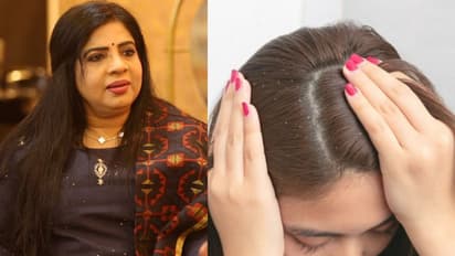 താരനും തലമുടി കൊഴിച്ചിലും തടയാന്; ടിപ്സ് പങ്കുവച്ച് അനില ജോസഫ്...