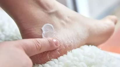 പാദങ്ങള് വിണ്ടുകീറുന്നത് തടയാൻ ഇതാ ചില പൊടിക്കെെകൾ