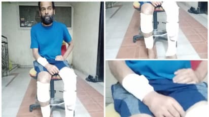 ജോലി കഴിഞ്ഞ് മടങ്ങുന്നതിനിടെ മോഷ്ടാക്കളുടെ ആക്രമണം; പ്രവാസി മലയാളിക്ക് ഗുരുതര പരിക്ക്