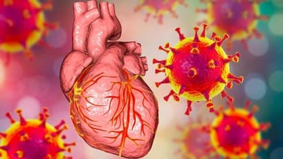 அதிகரிக்கும் மாரடைப்பு.. மாரடைப்பிற்கும், கொரோனாவிற்கும் தொடர்பு இருக்கா.? மத்திய அரசு பகீர் தகவல்