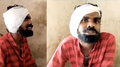 കൊല്ലത്ത് ഉത്സത്തിനെത്തിയ യുവാവിന്‍റെ ചെവി ലാത്തികൊണ്ട് അടിച്ചുതകർത്തു;  പൊലീസിനെതിരെ പരാതി  