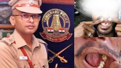 பல் பிடுங்கிய விவகாரத்தில் பல்வீர் சிங் மீது வழக்கு பதிவு.! கடுமையான தண்டனை வழங்கிடுக- கே.பாலகிருஷ்ணன்