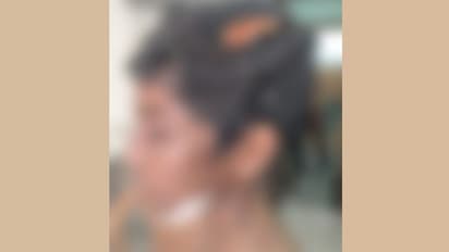 വീണ് പരിക്കേറ്റെന്ന് പറഞ്ഞ് ആശുപത്രിയിൽ, ഡോക്ടര്‍ക്ക്  സംശയം, വെളിവായത് 12 -കാരനോട് രണ്ടാനച്ഛൻ കാണിച്ച ക്രൂരത