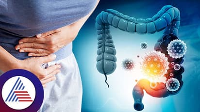 Colon Cancer: 16 ವಾರದ ಗರ್ಭಿಣಿ ಎಂದುಕೊಂಡಿದ್ದ ಡಾಕ್ಟರ್ಗೆ ಬಿಗ್ ಶಾಕ್