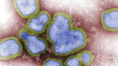 Health Tips: എന്താണ് H3N8 വൈറസ്? തിരിച്ചറിയാം ഈ ലക്ഷണങ്ങളെ...