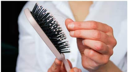 മുടികൊഴിച്ചിൽ അകറ്റാൻ പരീക്ഷിക്കാം ഈ പൊടിക്കെെകൾ 