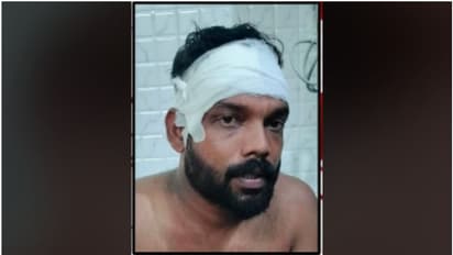 ഡിവൈഎഫ്ഐ നേതാവിനെ തലയ്ക്കടിച്ച് കൊല്ലാന് ശ്രമം; ആക്രമിച്ചത് എസ്ഡിപിഐ പ്രവര്ത്തകരെന്ന് സിപിഐഎം