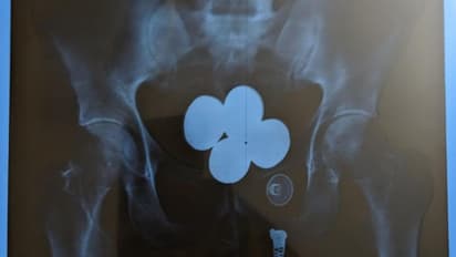 സ്വർണക്കടത്ത്: വിമാനത്താവളത്തിൽ കസ്റ്റംസിനെ വെട്ടിച്ചു; പുറത്ത് കടന്നപ്പോൾ പൊലീസ് 'പൊക്കി'