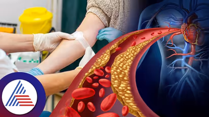 ಬ್ಯಾಡ್ ಕೊಲೆಸ್ಟ್ರಾಲ್ ಇದ್ರೆ ಡೇಂಜರ್, ನಿಮ್ಮ ರಕ್ತದಲ್ಲಿದು ಇದೆಯಾ ಚೆಕ್ ಮಾಡ್ಕೊಳ್ಳಿ!