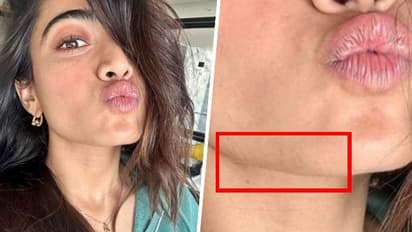 Rashmika Mandanna gets trolled for 'facial hair' in her latest selfie; netizens share some close-up photos