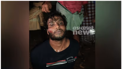 കിള്ളിമംഗലം ആൾക്കൂട്ട മർദ്ദനം; യുവാവിന്റെ ആരോഗ്യനില ഗുരുതരമായി തുടരുന്നു