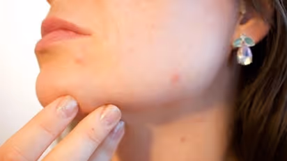 കൊളസ്ട്രോള്‍ കൂടുതലായാല്‍ അത് മുഖത്ത് അറിയാം; എങ്ങനെയെന്ന് മനസിലാക്കൂ...