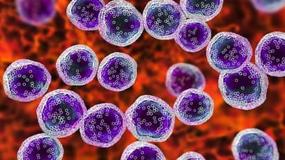 What is Lymphoma? Know its symptoms, causes and treatment