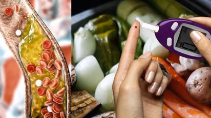 കൊളസ്ട്രോളും പ്രമേഹവും നിയന്ത്രിക്കാന്‍ ഡയറ്റില്‍ ഉള്‍പ്പെടുത്താം ഈ ആറ് ഭക്ഷണങ്ങള്‍...