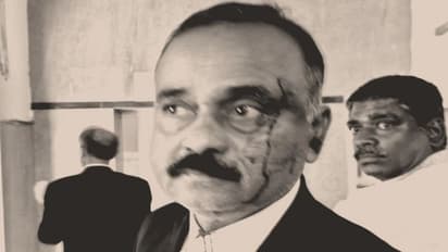 Bengaluru: ಚೆಕ್ ಬೌನ್ಸ್ ಪ್ರಕರಣದ ಸಂಧಾನಕ್ಕೆ ಒಪ್ಪದ ವಕೀಲನಿಗೆ ಇರಿದ ಮಹಿಳೆ!