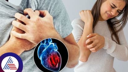 ಹೃದಯಾಘಾತಕ್ಕೂ ಮೊದಲು ಚರ್ಮದಲ್ಲಿ ಹೀಗೆಲ್ಲಾ ಬದಲಾವಣೆಯಾಗುತ್ತೆ, ಗಮನಿಸ್ಕೊಳ್ಳಿ