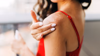 How to protect your skin from heat rashes and sunburns? Here are 5 easy ways