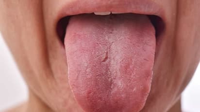 Health Tips: మీ నాలుక రంగు మారుతుందా.. అయితే ఈ సమస్యలు తప్పవు?