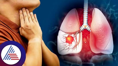 Lungs Cancer: ಸ್ಮೋಕ್ ಮಾಡದ ಭಾರತೀಯರಿಗೂ ಕಾಡುತ್ತಿದೆ ಈ ಅನಾರೋಗ್ಯ!