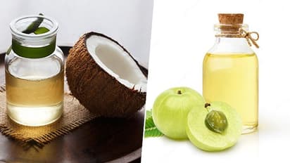 Three indigenous Ayurvedic oils which can help you in reducing hair loss