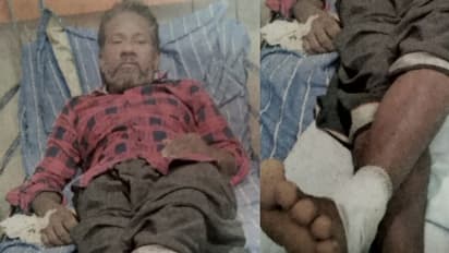 പേര് ചോദിച്ച് ഉറപ്പാക്കി, മുഖത്ത് മുളക് പൊടി വിതറി; പ്രഭാത നടത്തത്തിനിറങ്ങിയ ആൾക്കുനേരെ ഗുണ്ടാ ആക്രമണം