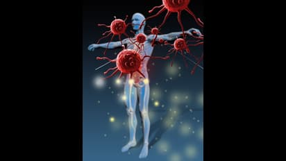 ഈ ഭക്ഷണങ്ങൾ ഒഴിവാക്കൂ, പ്രതിരോധശേഷി കുറയ്ക്കും 