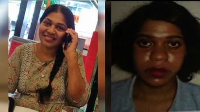 അയൽവാസിയുടെ കാൽ തല്ലി ഒടിക്കാൻ ക്വട്ടേഷൻ; അമ്മയെയും മകളെയും പിടികൂടാനായില്ല, ജില്ല വിട്ടെന്ന് സംശയം