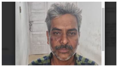 പാചകം ചെയ്യുകയായിരുന്ന ഭാര്യയുടെ മുഖത്ത് തിളച്ച എണ്ണയൊഴിച്ചു, ഭർത്താവ് അറസ്റ്റിൽ