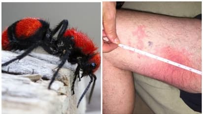 'പശു കൊലയാളി' ഉറുമ്പ് കടിച്ച അനുഭവം പങ്കുവച്ച് ഒരു വൈറല് കുറിപ്പ്