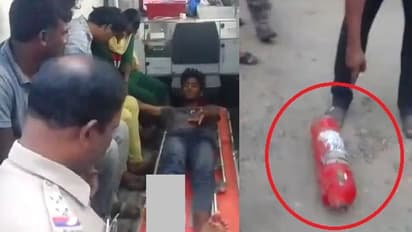 தீ அணைப்பான் உருளை வெடித்து விபத்து... இரண்டாக முறிந்த இளைஞரின் கால்!!