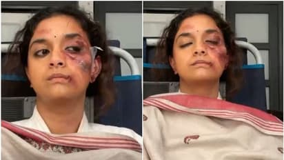 'സാനി കായിദം' ഒന്നാം വാര്ഷികത്തില് 'വ്യത്യസ്തമായ' ചിത്രങ്ങള് പങ്കുവച്ച് കീര്ത്തി