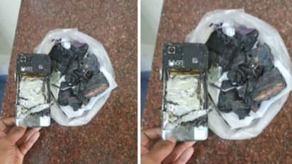 പാന്റിന്റെ പോക്കറ്റിലെ മൊബൈൽ ഫോൺ പൊട്ടിത്തെറിച്ചു, കോഴിക്കോട്ട് യുവാവിന് പരിക്ക്